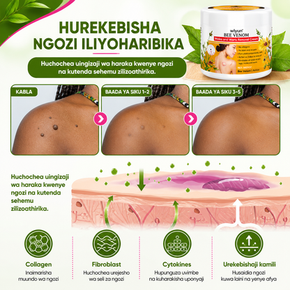 Warts Removal Cream